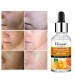 Disaar Vitamin C Whitening Face Serum with Hyaluronic Acid 30ml